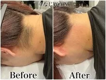 うなじWAX Before/After