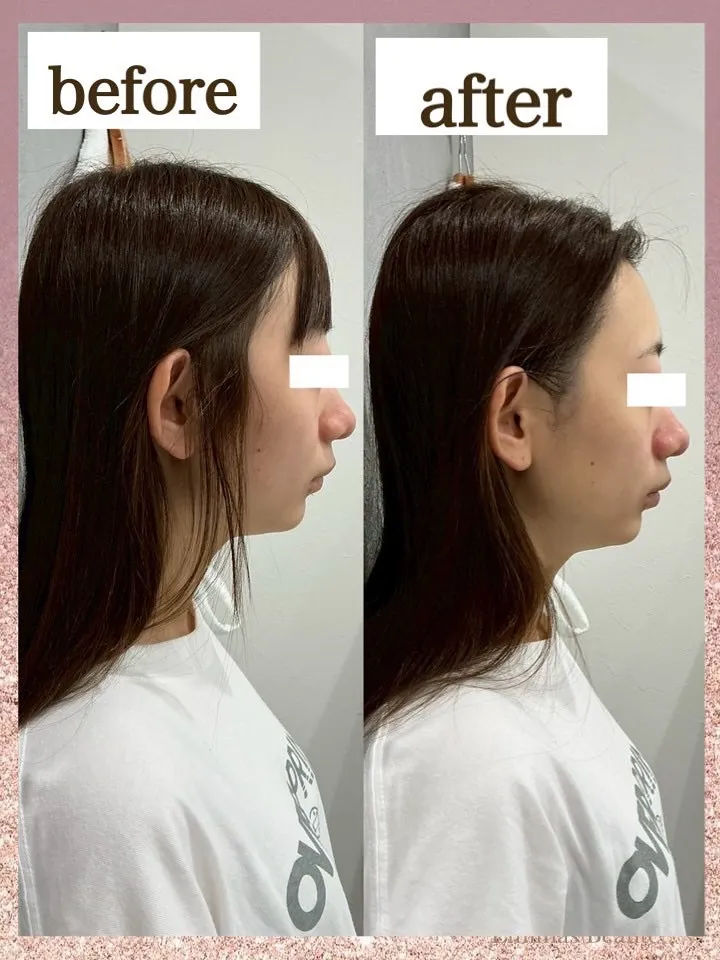 ２０代前半の元々とっても小顔なお客様🩷