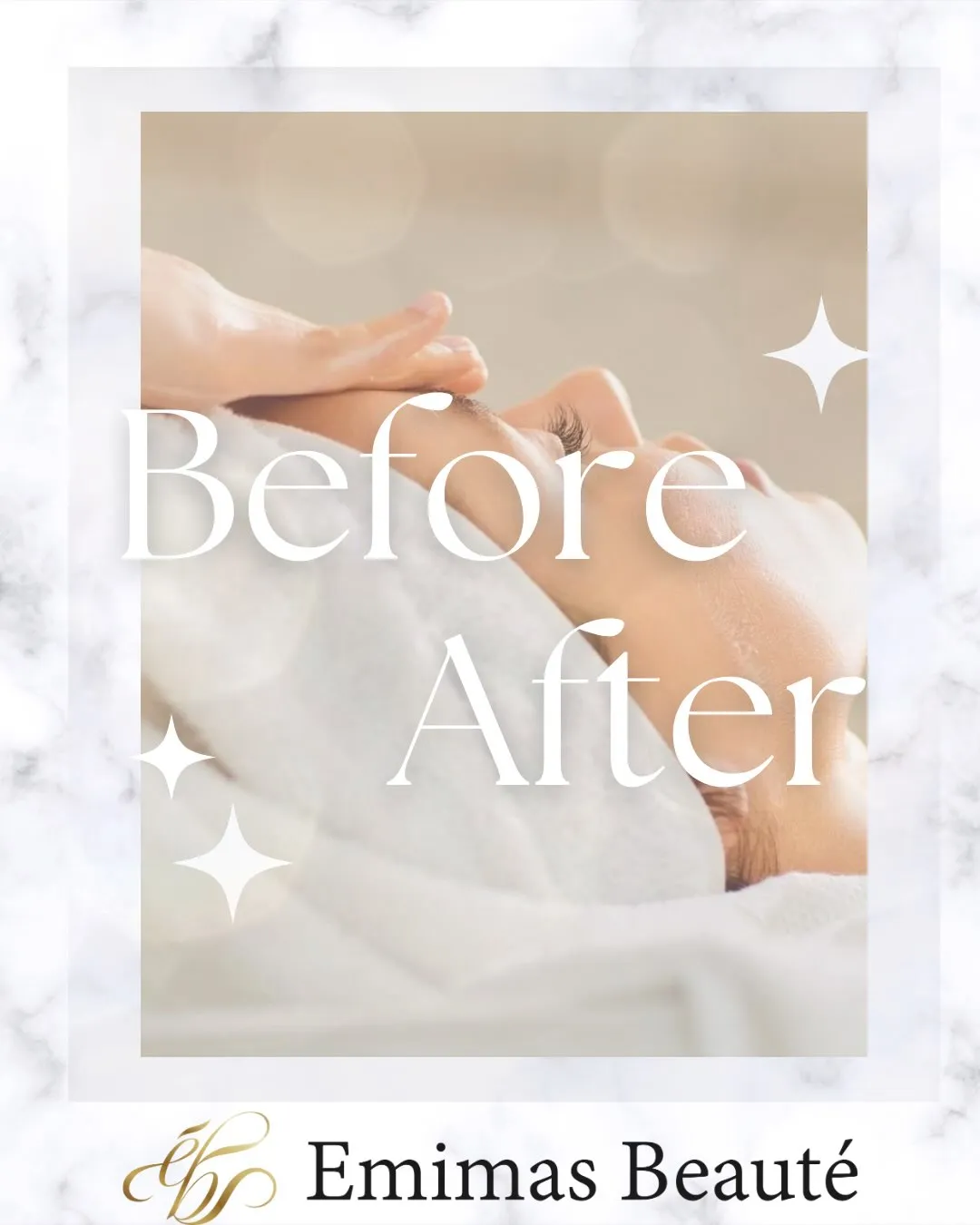 私のbefore▶︎after