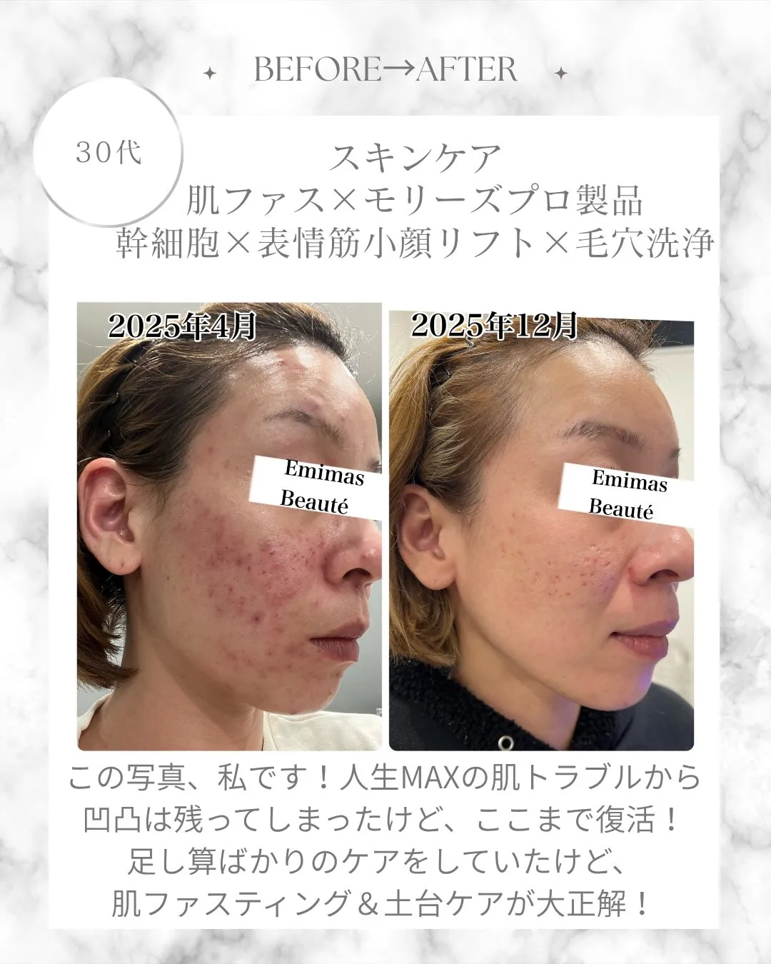 私のbefore▶︎after