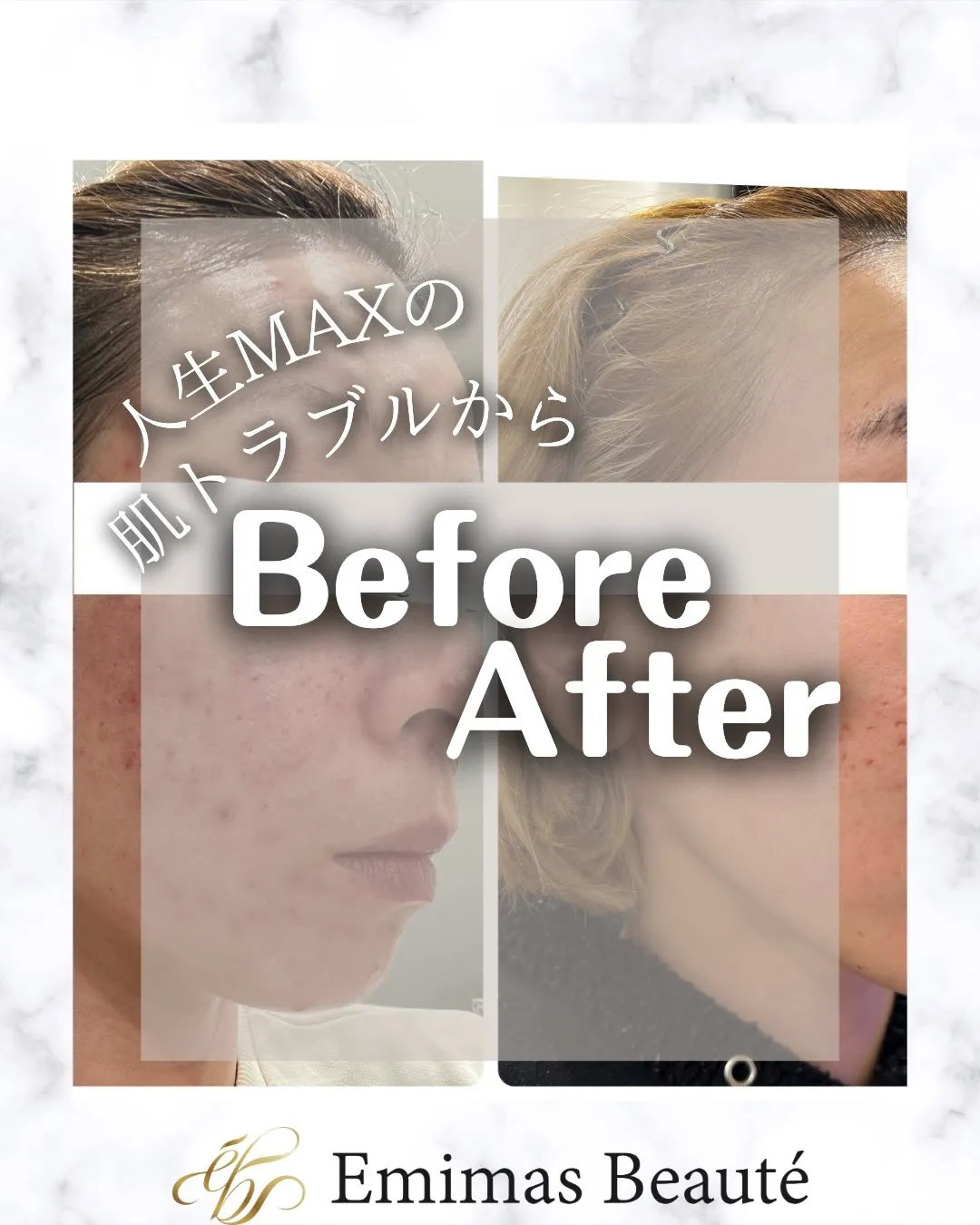 私のbefore▶︎after