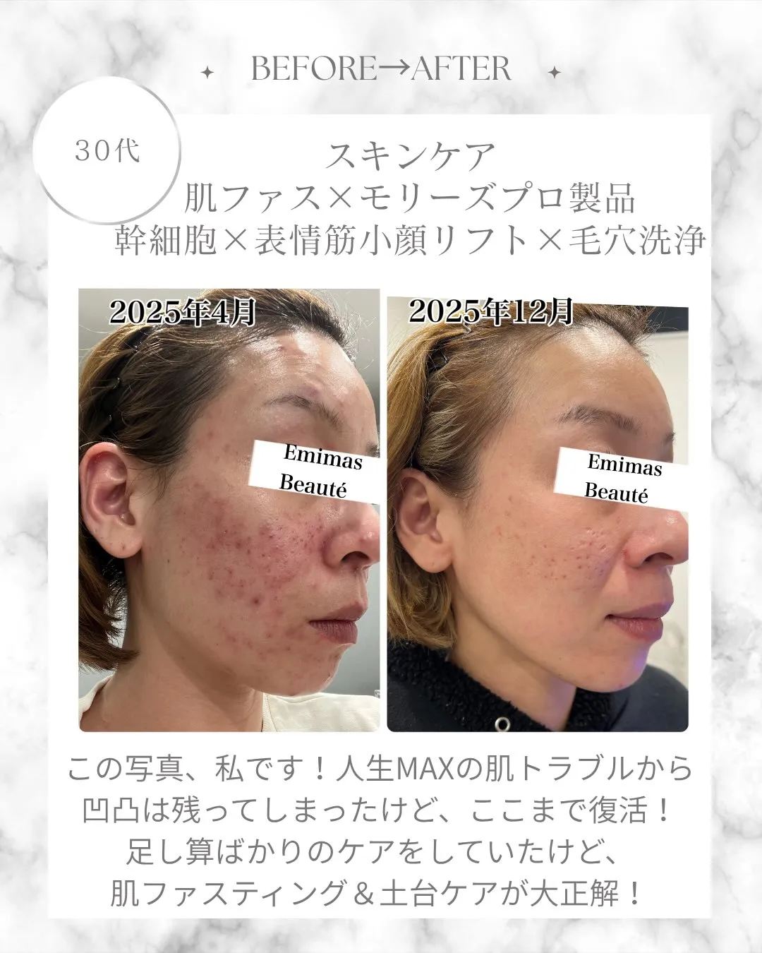 私のbefore▶︎after