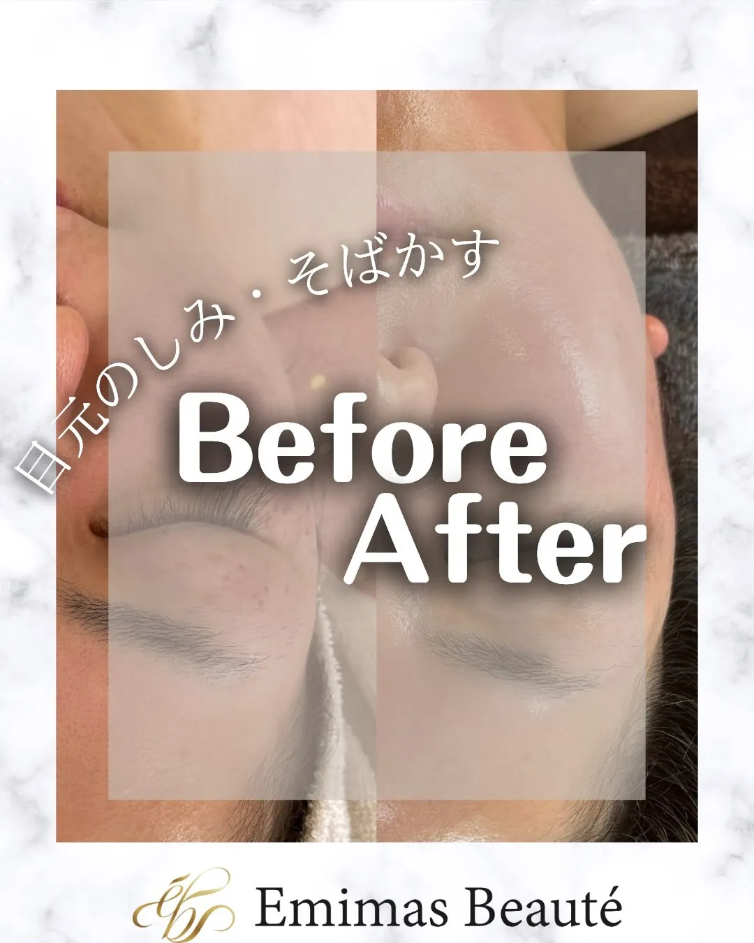 Emimas Beauté がこだわった幹細胞のすごいとこ...