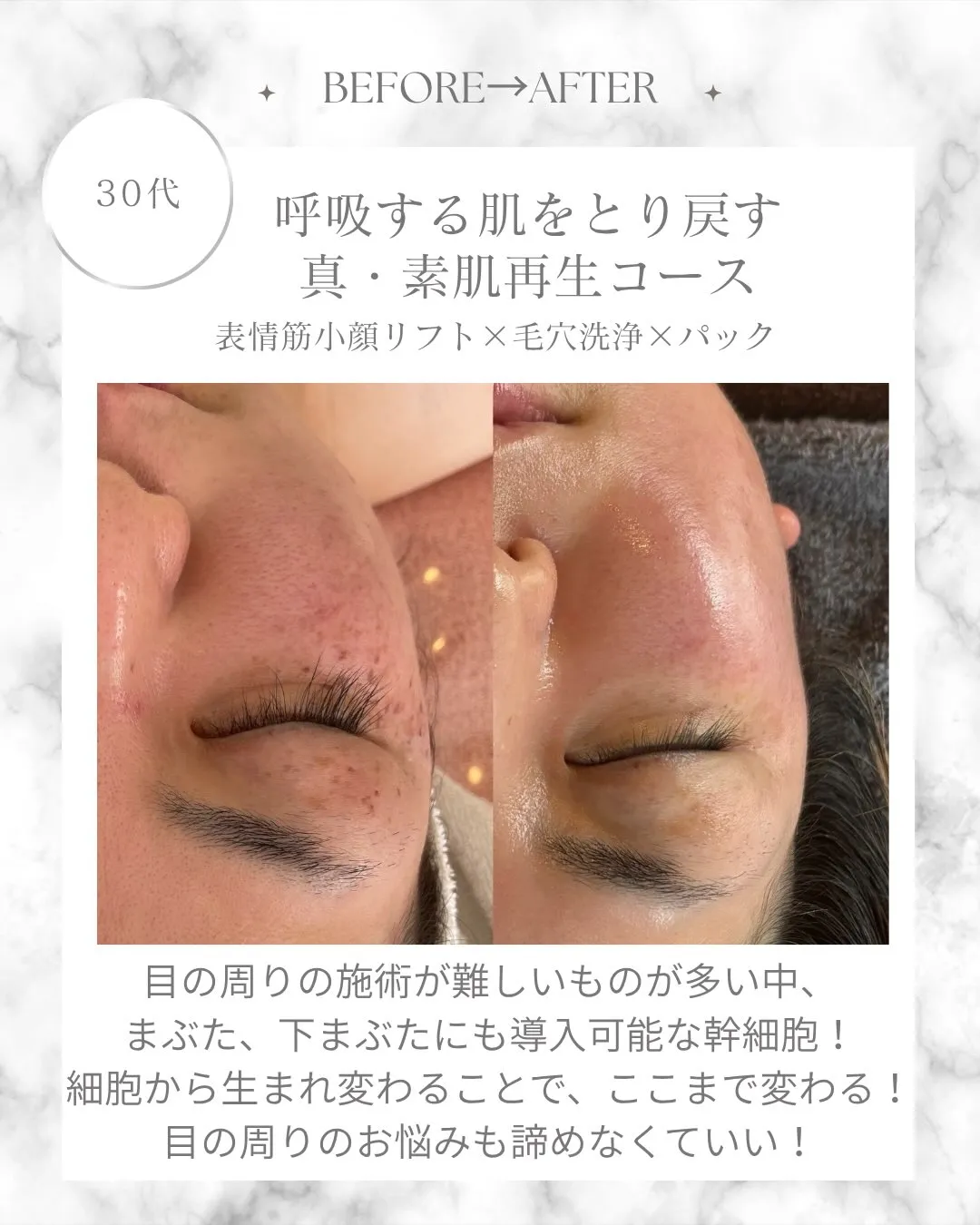 Emimas Beauté がこだわった幹細胞のすごいとこ...