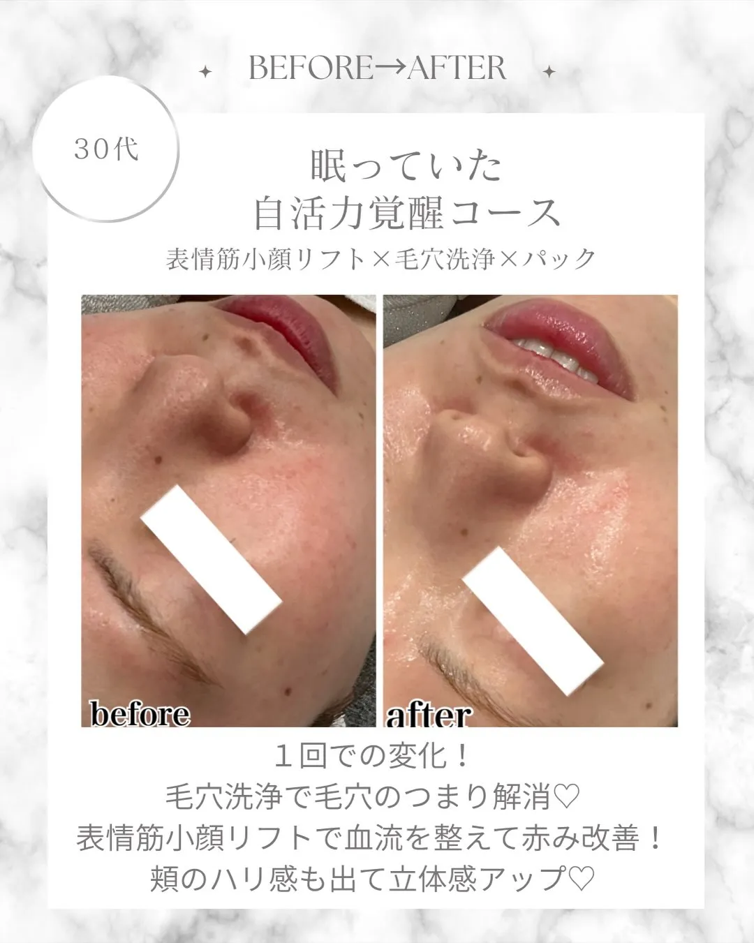 素肌力爆上がり♡