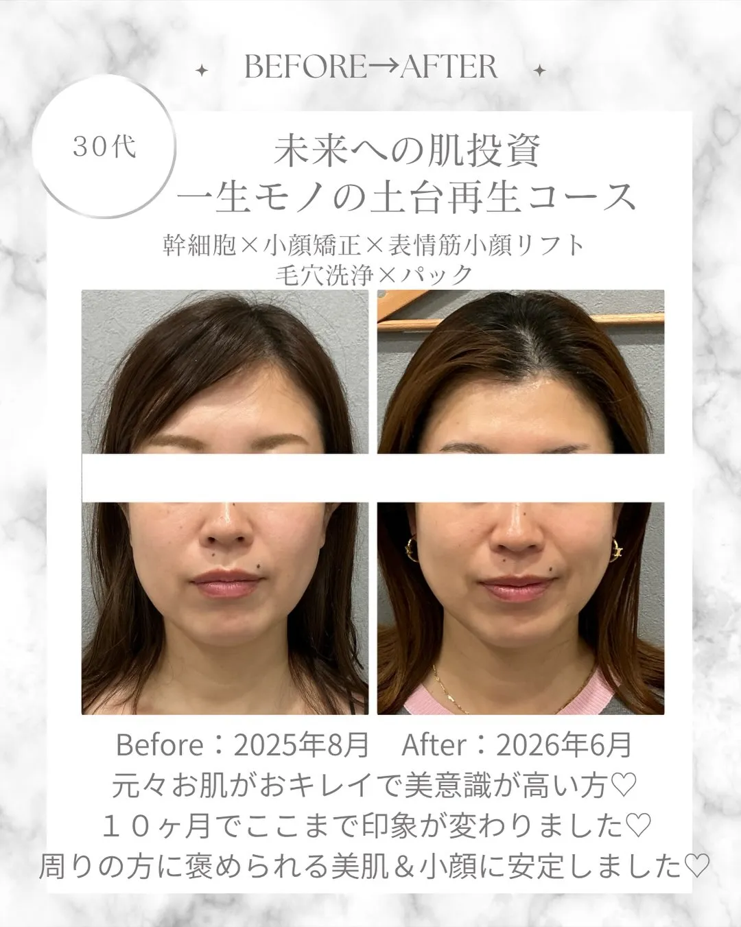 2025年8月に初めてお越しいただいて、今もお肌を任せてくだ...