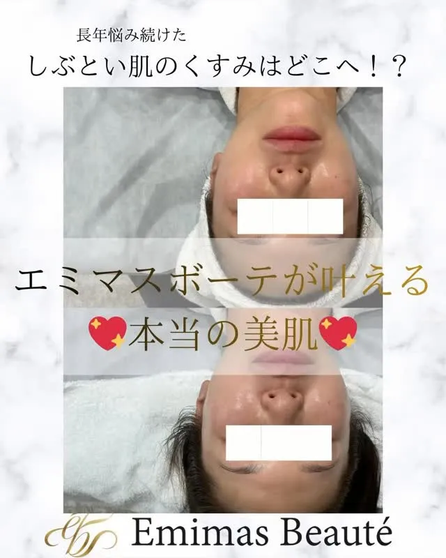 ４０代前半のお客様