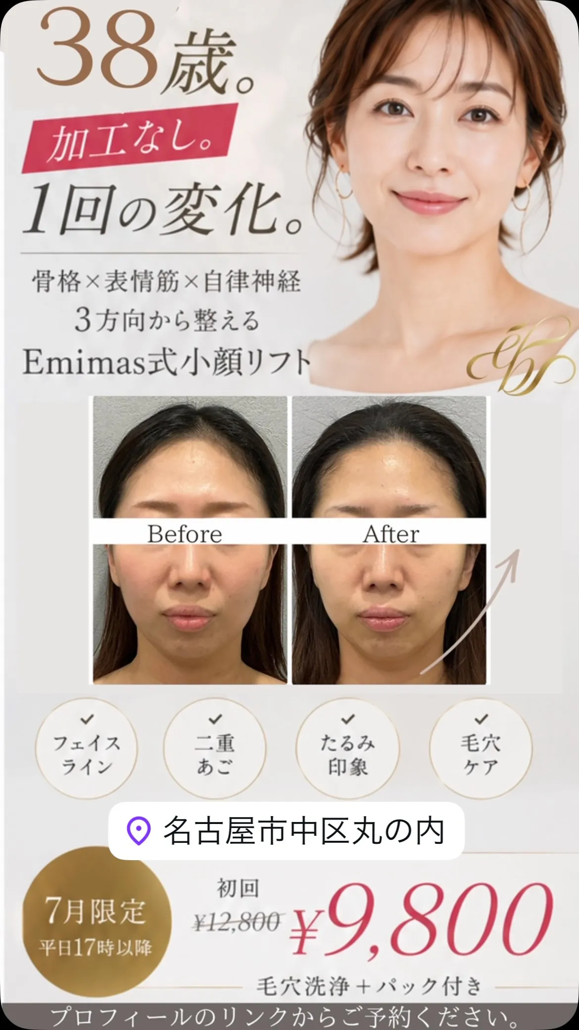 「フェイスラインがぼんやりしてきた」